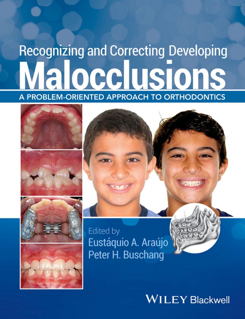 Big bigCover of Recognizing and Correcting Developing Malocclusions
