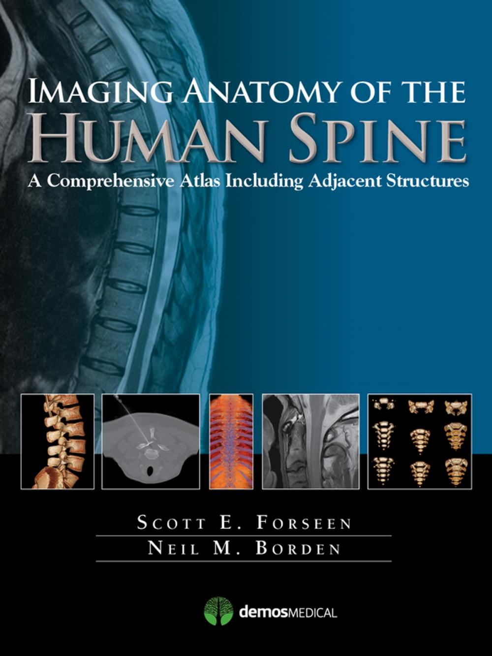 Big bigCover of Imaging Anatomy of the Human Spine