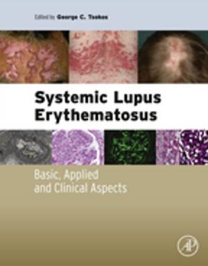 Cover of the book Systemic Lupus Erythematosus by V.S. Ramachandran, J.J. Beaudoin