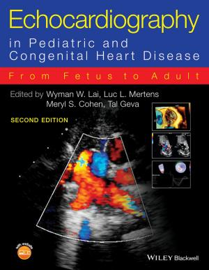 Cover of the book Echocardiography in Pediatric and Congenital Heart Disease by Edwin Amenta, Kate Nash, Alan Scott