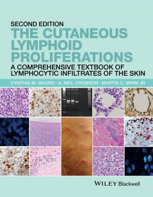 Book cover of The Cutaneous Lymphoid Proliferations