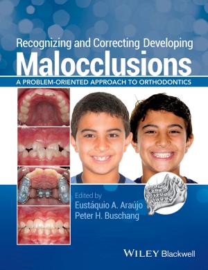 Cover of the book Recognizing and Correcting Developing Malocclusions by 