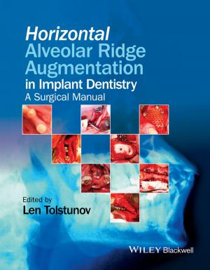 Cover of the book Horizontal Alveolar Ridge Augmentation in Implant Dentistry by Chris Thornhill