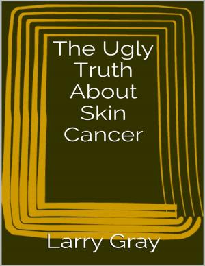 Cover of the book The Ugly Truth About Skin Cancer by Virinia Downham