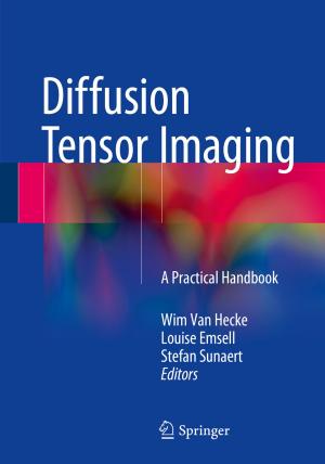 Cover of the book Diffusion Tensor Imaging by Ian Cooper, Stephen Chadwick