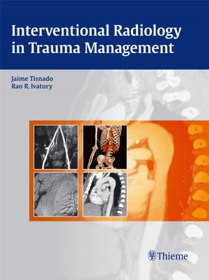 Cover of the book Interventional Radiology in Trauma by Robert A. Dickson, Juergen Harms