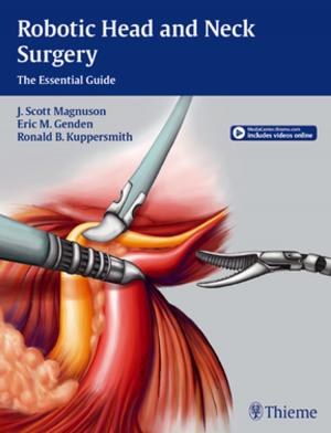 Cover of the book Robotic Head and Neck Surgery by David Goldenberg, Bradley J. Goldstein
