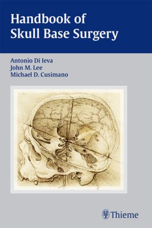 Cover of the book Handbook of Skull Base Surgery by Tibor Tot