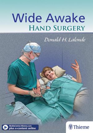 Cover of the book Wide Awake Hand Surgery by Robert Groves, Mark Parker, Joanna Kusmirek