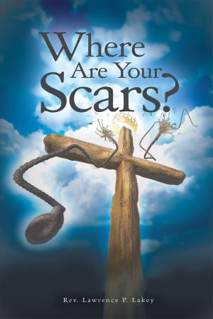 Cover of the book Where Are Your Scars? by Peter Shue, Terence Wallace