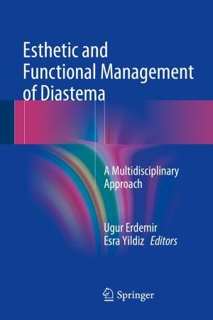 Cover of the book Esthetic and Functional Management of Diastema by 