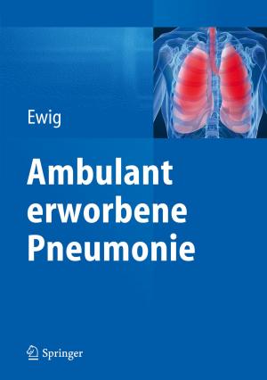 Cover of the book Ambulant erworbene Pneumonie by Wilhelm Schäberle