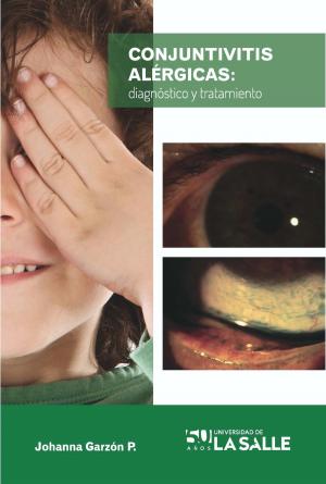 Cover of the book Conjuntivitis alérgicas by Liliana Garzón Forero