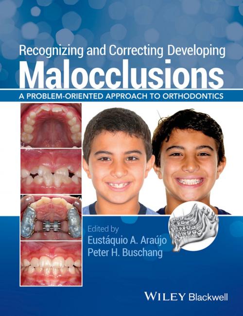 Cover of the book Recognizing and Correcting Developing Malocclusions by , Wiley