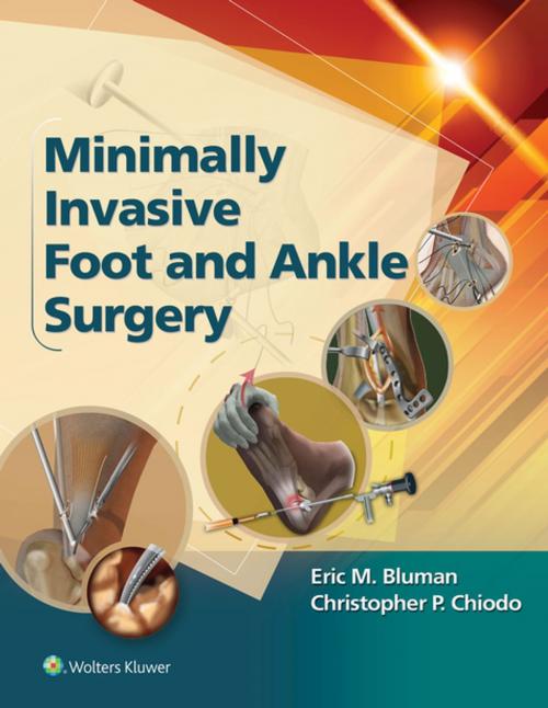 Cover of the book Minimally Invasive Foot & Ankle Surgery by Eric Bluman, Christopher Chiodo, Wolters Kluwer Health