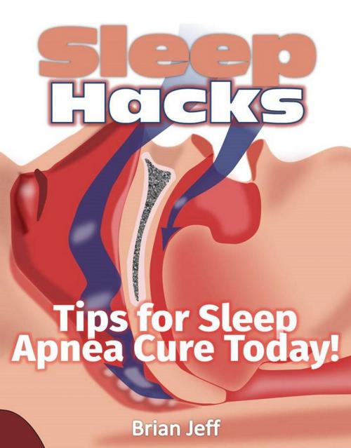 Cover of the book Sleep Hacks: Tips for Apnea Cure Today! by Brian Jeff, Eljays-epublishing