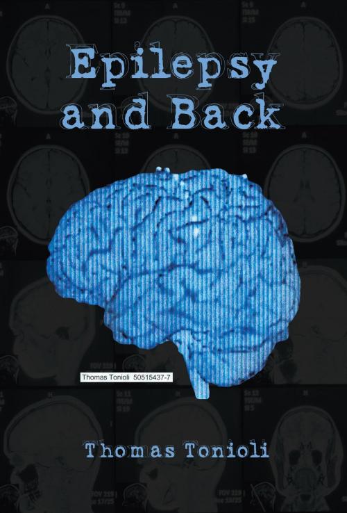 Cover of the book Epilepsy and Back by Thomas Tonioli, Green Ivy