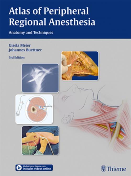 Cover of the book Atlas of Peripheral Regional Anesthesia by Gisela Meier, Johannes Buettner, Thieme