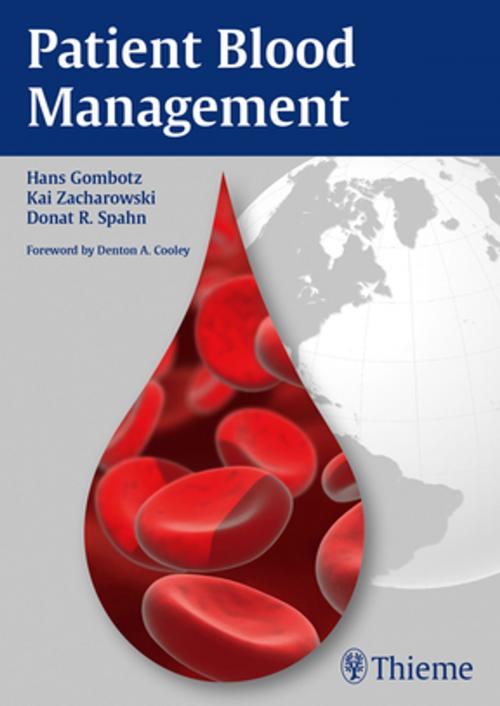 Cover of the book Patient Blood Management by Hans Gombotz, Kai Zacharowski, Donat Rudolf Spahn, Thieme