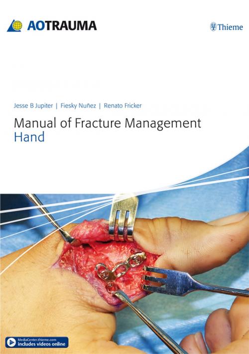 Cover of the book Manual of Fracture Management - Hand by , Thieme