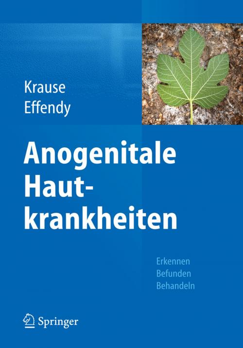 Cover of the book Anogenitale Hautkrankheiten by , Springer Berlin Heidelberg
