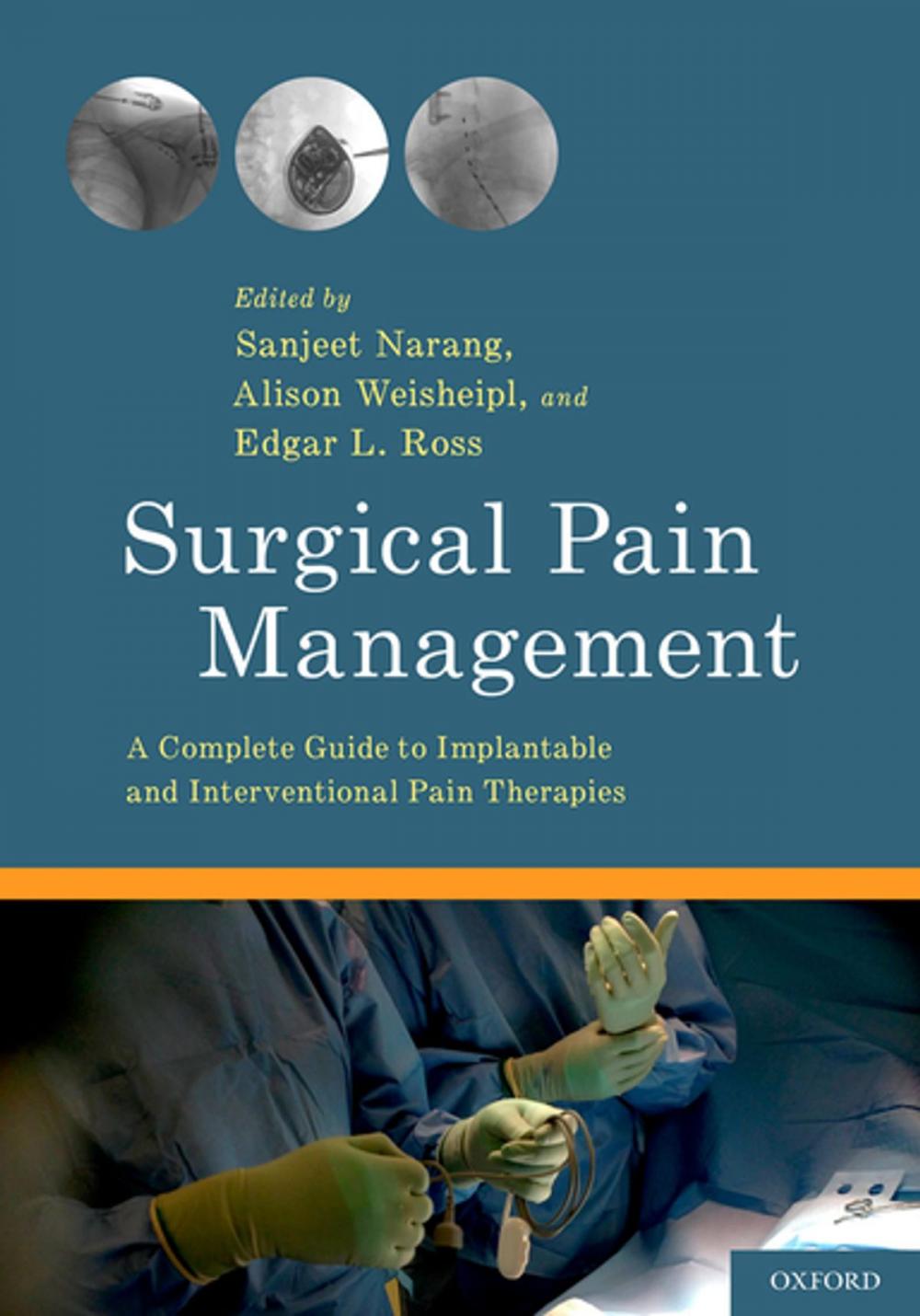 Big bigCover of Surgical Pain Management