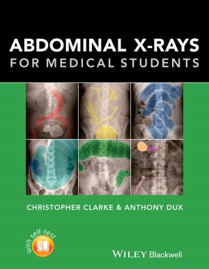 Cover of the book Abdominal X-rays for Medical Students by Elizabeth Wright