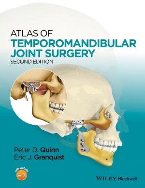 Cover of the book Atlas of Temporomandibular Joint Surgery by Chris Chopdar, Neel Burton