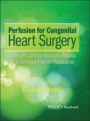 Cover of the book Perfusion for Congenital Heart Surgery by Timothy Rooney