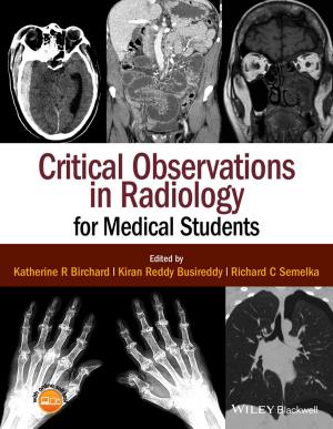 Cover of the book Critical Observations in Radiology for Medical Students by Mark Phillips, Jon Chappell