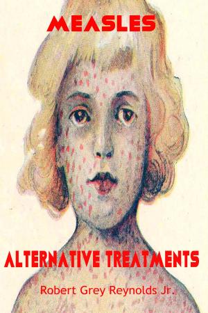 Book cover of Measles Alternative Treatments