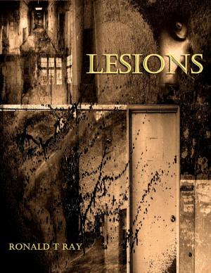 Cover of the book Lesions by Nicole Woodinville