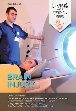 Cover of the book Brain Injury by Gabrielle Vanderhoof