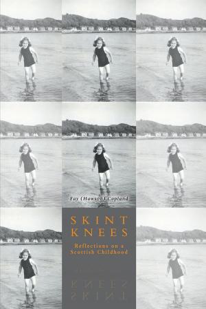 Cover of the book Skint Knees by Moira Leigh MacLeod