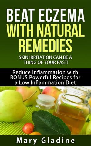 Book cover of Beat Eczema: Skin Irritation can be a thing of your past! Natural Eczema Remedies PLUS Reduce Inflammation with BONUS Powerful Recipes and Food Tips for a Low Inflammation Diet