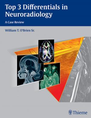 Cover of the book Top 3 Differentials in Neuroradiology by Uwe Fischer, Friedemann Baum