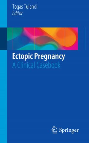 Cover of the book Ectopic Pregnancy by Kumar Pakki Bharani Chandra, Da-Wei Gu