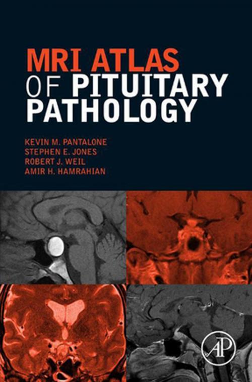 Cover of the book MRI Atlas of Pituitary Pathology by Robert J. Weil, Amir H. Hamrahian, Kevin M. Pantalone, DO, ECNU, CCD, Stephen E. Jones, PhD, Elsevier Science