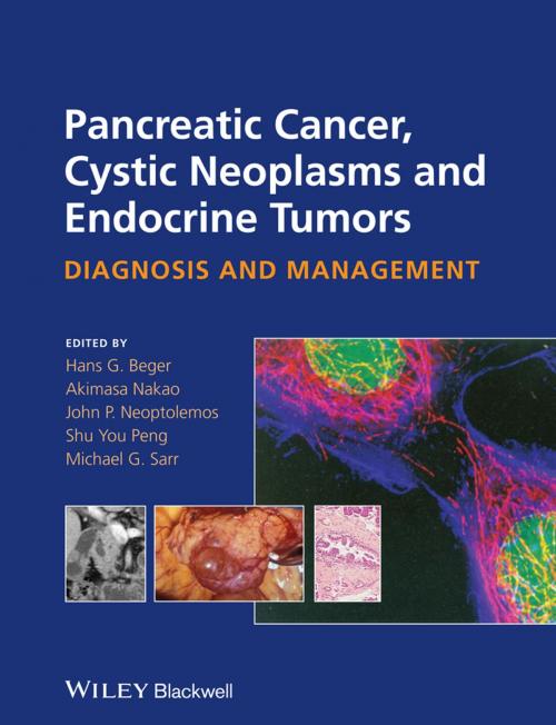 Cover of the book Pancreatic Cancer, Cystic Neoplasms and Endocrine Tumors by , Wiley