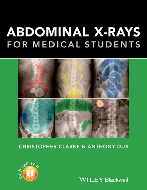 Cover of the book Abdominal X-rays for Medical Students by Christopher Clarke, Anthony Dux, Wiley