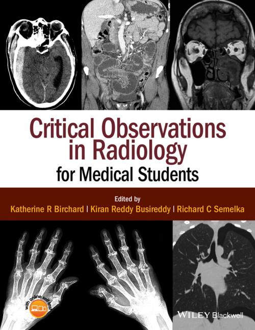 Cover of the book Critical Observations in Radiology for Medical Students by Katherine R. Birchard, Kiran Reddy Busireddy, Richard C. Semelka, Wiley