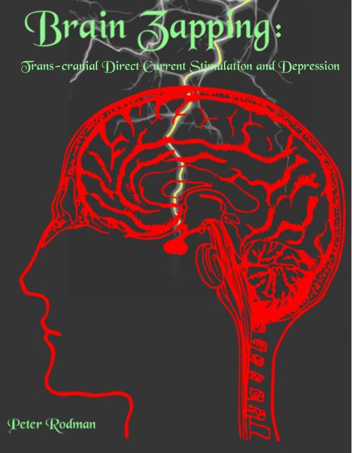 Cover of the book Brain Zapping: Trans-crainial Direct Current Stimulation and Depression by Peter Rodman, Peter Rodman