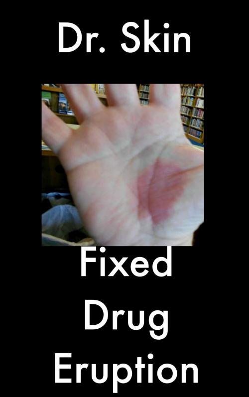 Cover of the book Fixed Drug Eruption by Dr Skin, Dr Skin