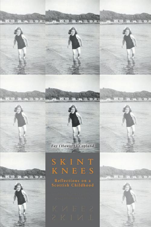 Cover of the book Skint Knees by Fay (Hawson) Copland, FriesenPress