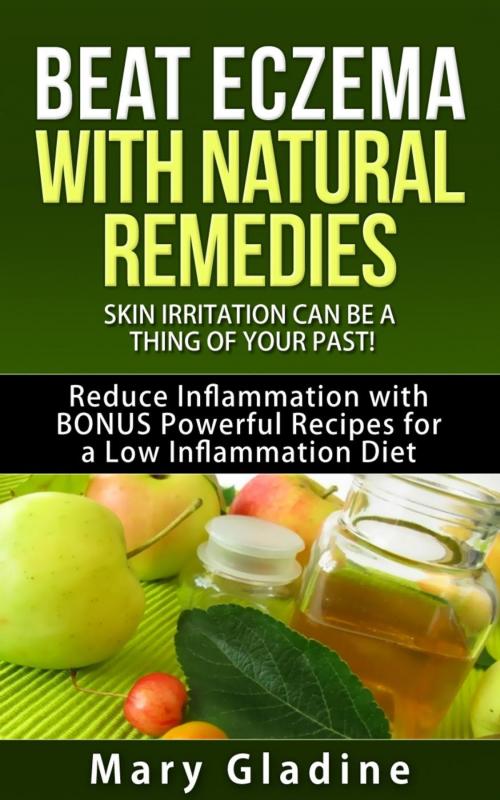 Cover of the book Beat Eczema: Skin Irritation can be a thing of your past! Natural Eczema Remedies PLUS Reduce Inflammation with BONUS Powerful Recipes and Food Tips for a Low Inflammation Diet by Mary Gladine, RMI Publishing