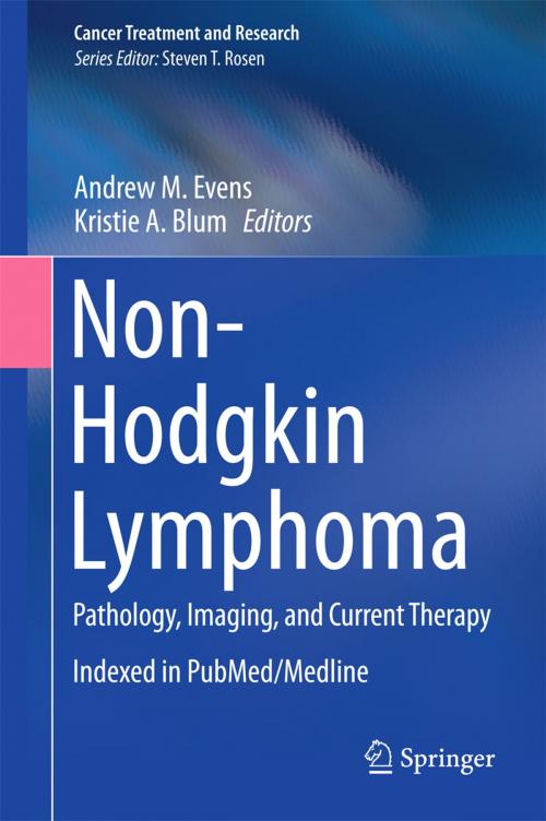 Cover of the book Non-Hodgkin Lymphoma by , Springer International Publishing