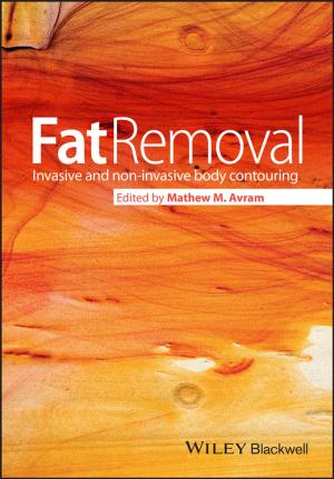 Cover of the book Fat Removal by Friedrich Bergler