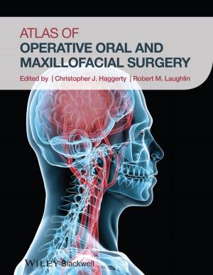 Cover of the book Atlas of Operative Oral and Maxillofacial Surgery by Duncan Angwin, Chris Smith, Stephen Cummings