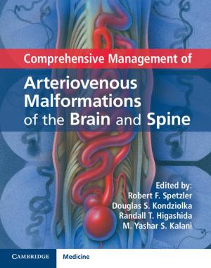 Cover of the book Comprehensive Management of Arteriovenous Malformations of the Brain and Spine by Allan C. Hutchinson