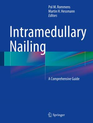 Cover of the book Intramedullary Nailing by Jorge Sousa Pinto, Maria João Frade, Simão Melo de Sousa, José Bacelar Almeida
